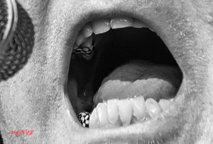 Rick Nielsen of Cheap Trick. Checkerboard teeth. ©2017 Steve Ziegelmeyer